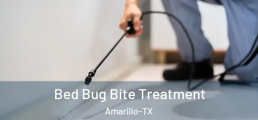 Bed Bug Bite Treatment Amarillo-TX